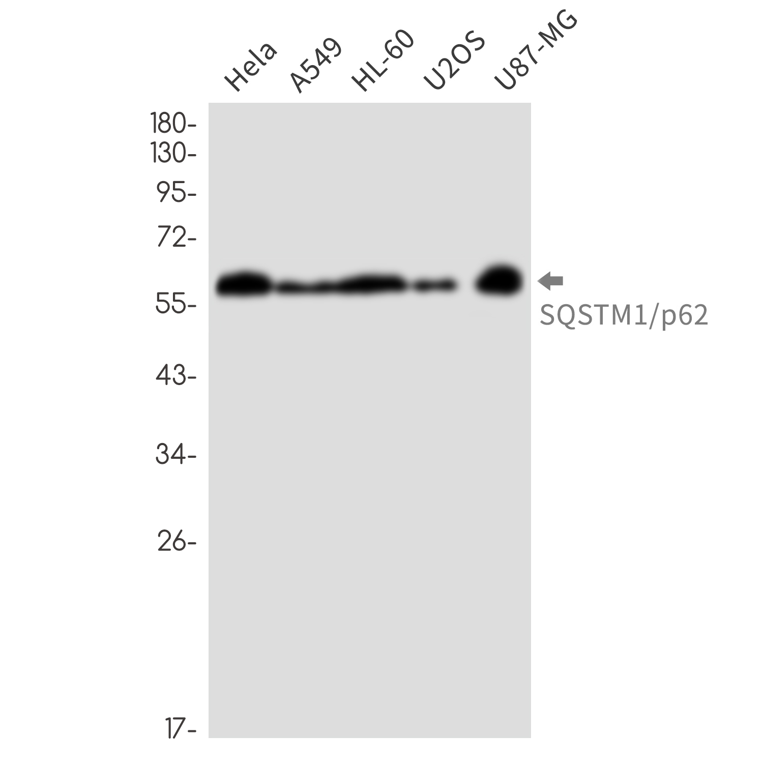 IF - SQSTM1/p62 Rabbit mAb AP76898